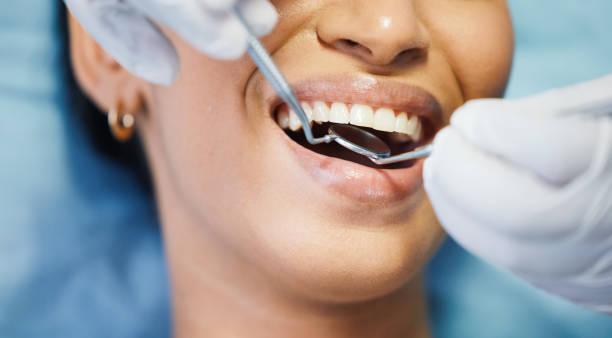 Best Dentist for Severe Toothache  in Bartonvle, IL